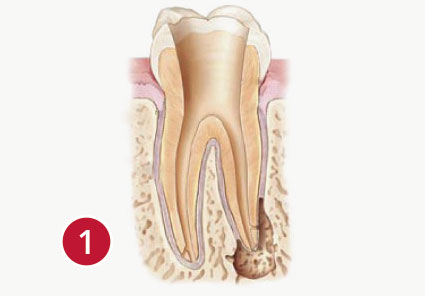 Endodontie Praxis Fur Endodontie Dr Silke Holderrieth